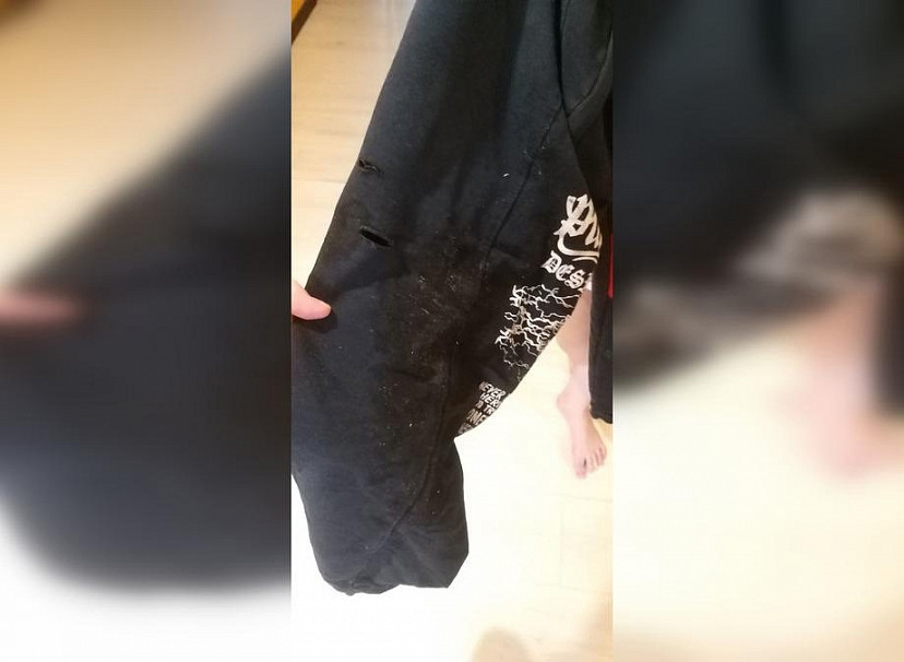 В сквере Саратова бездомная собака покусала 8-летнего мальчика