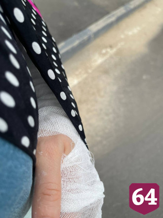 Ведущая Первого канала из Саратова сломала руку на мокром полу