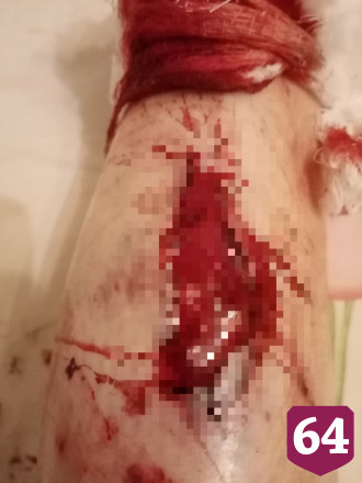 Две жительницы Саратова попали в больницу после нападения собак