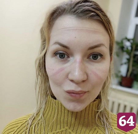 Саратовские врачи подружились с переболевшими коронавирусом пациентами