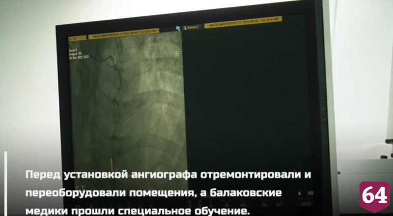 В сосудистом центре под Саратовом провели уникальную операцию на сердце