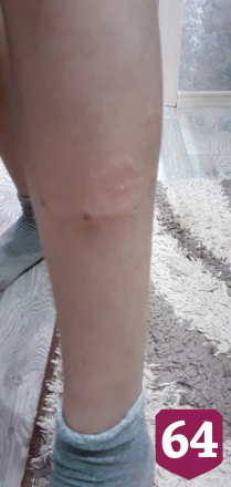 Житель Саратова спас мальчика от стаи собак