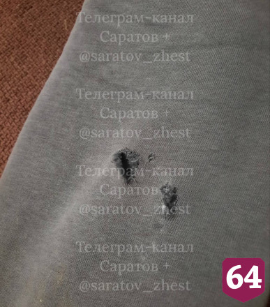 В Саратове бродячая собака прокусила женщине ногу