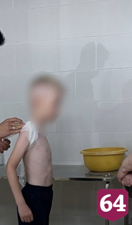 Самокатчики сбили 7-летнего мальчика на Рахова