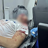 В Саратовской области посетитель бара пострадал после конфликта с охранником