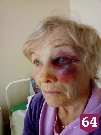 Чиновника районной администрации обвинили в избиении бывшей тещи
