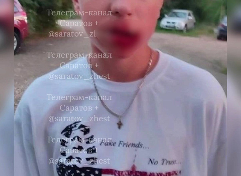 На дачах под Энгельсом избили подростка