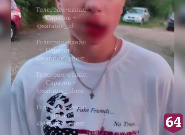 На дачах под Энгельсом избили подростка