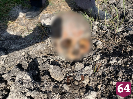 Саратовец во дворе копал траншею и нашел череп и кости человека  