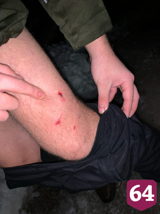 Бездомные собаки покусали 30-летнего жителя Саратова