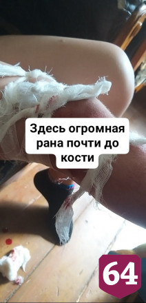 В сквере Саратова бездомная собака покусала 8-летнего мальчика