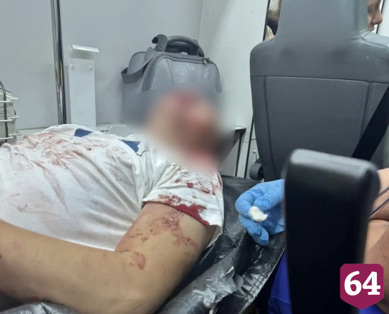 В Саратовской области посетитель бара пострадал после конфликта с охранником
