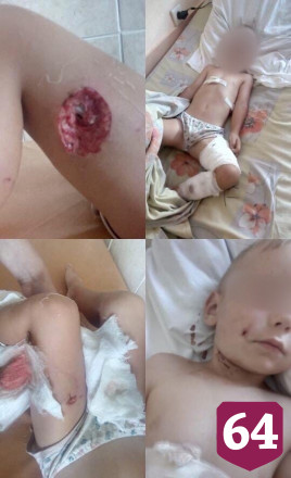 Управление ветеринарии прокомментировало нападение алабая на 3-летнего мальчика