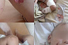 Управление ветеринарии прокомментировало нападение алабая на 3-летнего мальчика