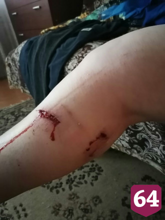 Стая бродячих собак напала на горожанку